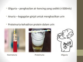 • Oliguria – penghasilan air kencing yang sedikit (<500mls)
• Anuria – kegagalan ginjal untuk menghasilkan urin
• Proteinuria-kehadiran protein dalam urin

Haematuria

Proteinuria

Oliguria

 