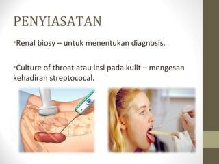 PENYIASATAN
•Renal biosy – untuk menentukan diagnosis.
•Culture of throat atau lesi pada kulit – mengesan
kehadiran streptococal.

 