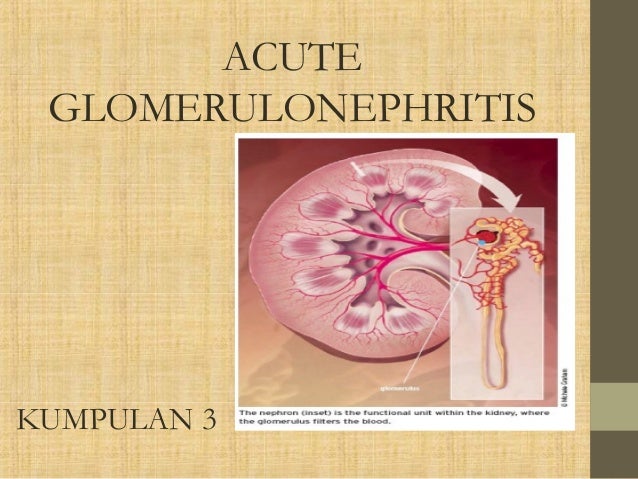 Acute gromerulonephritis