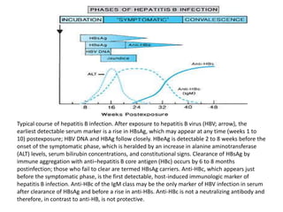 Typical course of hepatitis B infection. After exposure to hepatitis B virus (HBV; arrow), the
earliest detectable serum marker is a rise in HBsAg, which may appear at any time (weeks 1 to
10) postexposure; HBV DNA and HBAg follow closely. HBeAg is detectable 2 to 8 weeks before the
onset of the symptomatic phase, which is heralded by an increase in alanine aminotransferase
(ALT) levels, serum bilirubin concentrations, and constitutional signs. Clearance of HBsAg by
immune aggregation with anti–hepatitis B core antigen (HBc) occurs by 6 to 8 months
postinfection; those who fail to clear are termed HBsAg carriers. Anti-HBc, which appears just
before the symptomatic phase, is the first detectable, host-induced immunologic marker of
hepatitis B infection. Anti-HBc of the IgM class may be the only marker of HBV infection in serum
after clearance of HBsAg and before a rise in anti-HBs. Anti-HBc is not a neutralizing antibody and
therefore, in contrast to anti-HB, is not protective.
 