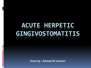 ACUTE HERPETIC
GINGIVOSTOMATITIS


   Done by : Ahmed Al-Asmari
 