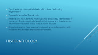 HISTOPATHOLOGY
 The virus targets the epithelial cells which show “ballooning
degeneration”
 These cells are called Tzanck cells.
 Infected cells fuse , forming multinucleated cells and IC edema leads to
formation of an intraepithelial vesicles that rupture and develops a sec.
inflammatory response with a fibro purulent exudate
 Discrete ulceration have a central portion of acute inflammation with
exudate surrounded by engorged blood vessels.
 