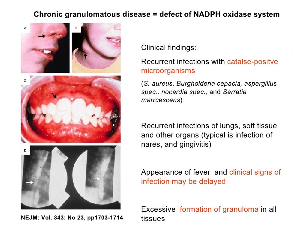Acute inflammation