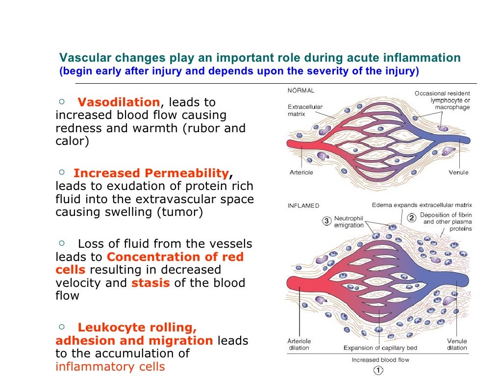 Acute inflammation