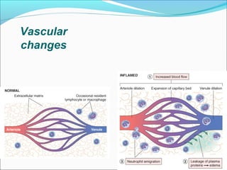 Vascular
changes
 