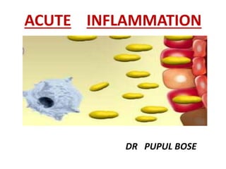 ACUTE INFLAMMATION
DR PUPUL BOSE
 