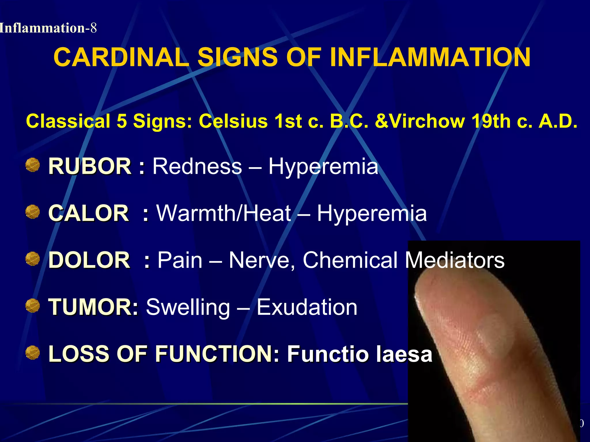 Pathology of Acute Inflammation | PPT