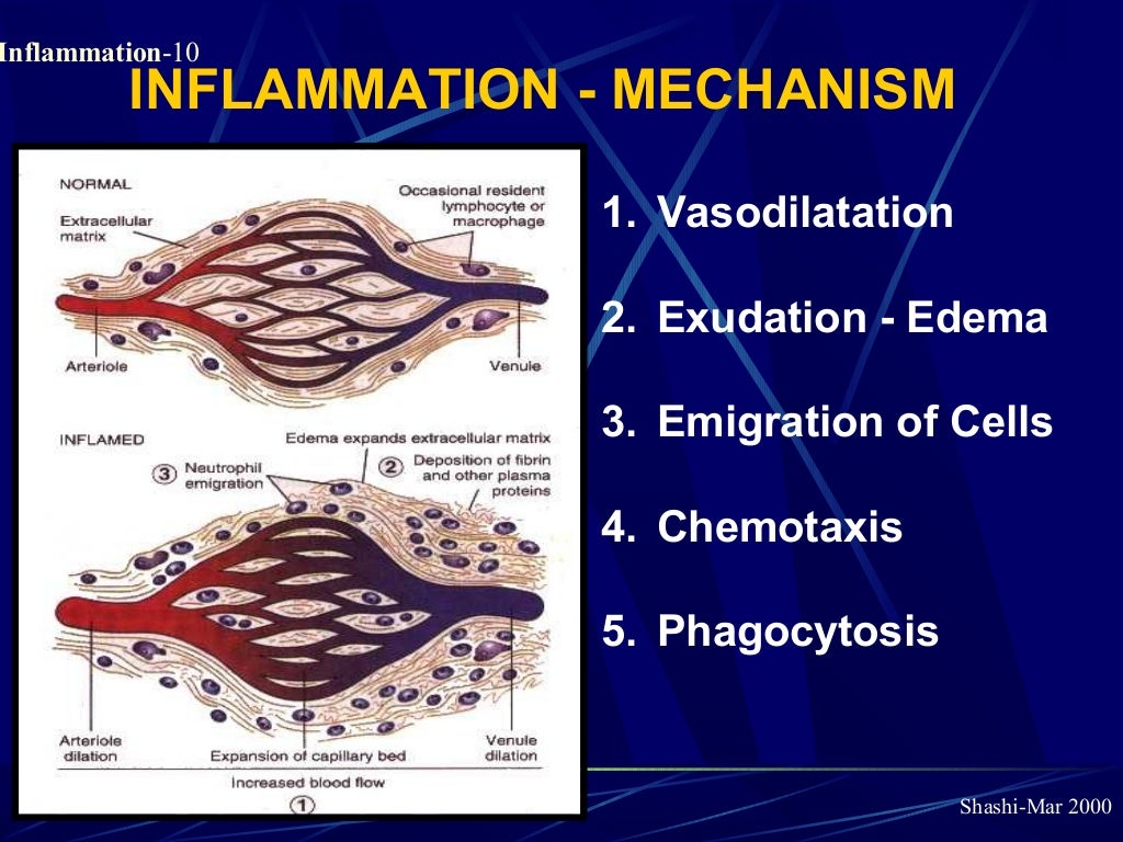 Pathology of Acute Inflammation