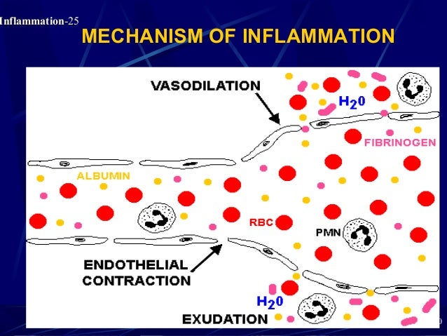 Pathology of Acute Inflammation