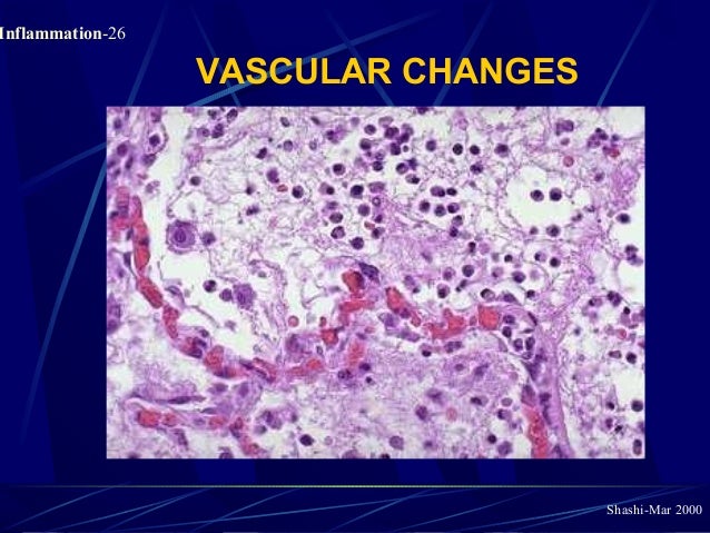 Pathology of Acute Inflammation