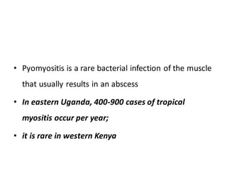 Infectious Pyomyositis Acute inflammatory conditions. A part of surgery in Clinical medicine | PDF