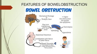 FEATURES OF BOWELOBSTRUCTION
 