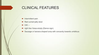 CLINICAL FEATURES
 Intermittent pain
 Red currant jelly stool
 O/E :-
 right iliac fossa empty (Dance sign)
 Sausage or banana shaped lump with concavity towards umbilicus
 