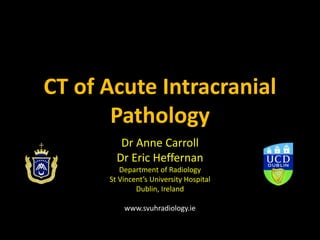 CT of Acute Intracranial
Pathology
Dr Anne Carroll
Dr Eric Heffernan
Department of Radiology
St Vincent’s University Hospital
Dublin, Ireland
www.svuhradiology.ie
 
