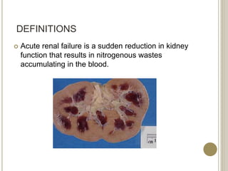 DEFINITIONS
 Acute renal failure is a sudden reduction in kidney
function that results in nitrogenous wastes
accumulating in the blood.
 