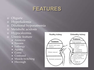  Oliguric
 Hyperkalemia
 Dilutional hyponatremia
 Metabolic acidosis
 Hypocalcemia
 Uremic feature
 Anorexia
 Nausea
 Lethargy
 Apathy
 Coma
 Confused
 Muscle twitching
 Hiccough
 