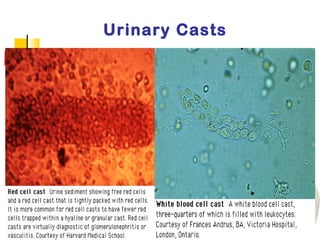 Acute kidney Injury | PPT