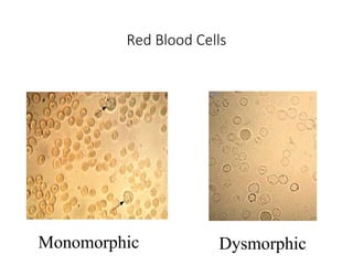 An overview of acute kidney injury/Acute renal disease.ppt