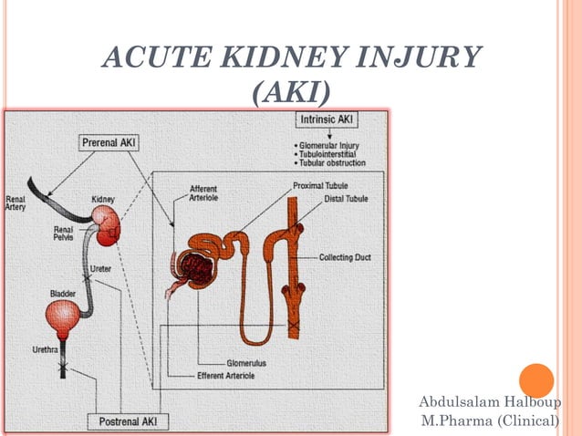 Acute Kidney Injury AKI PPT acute-kidney-injury-aki-ppt