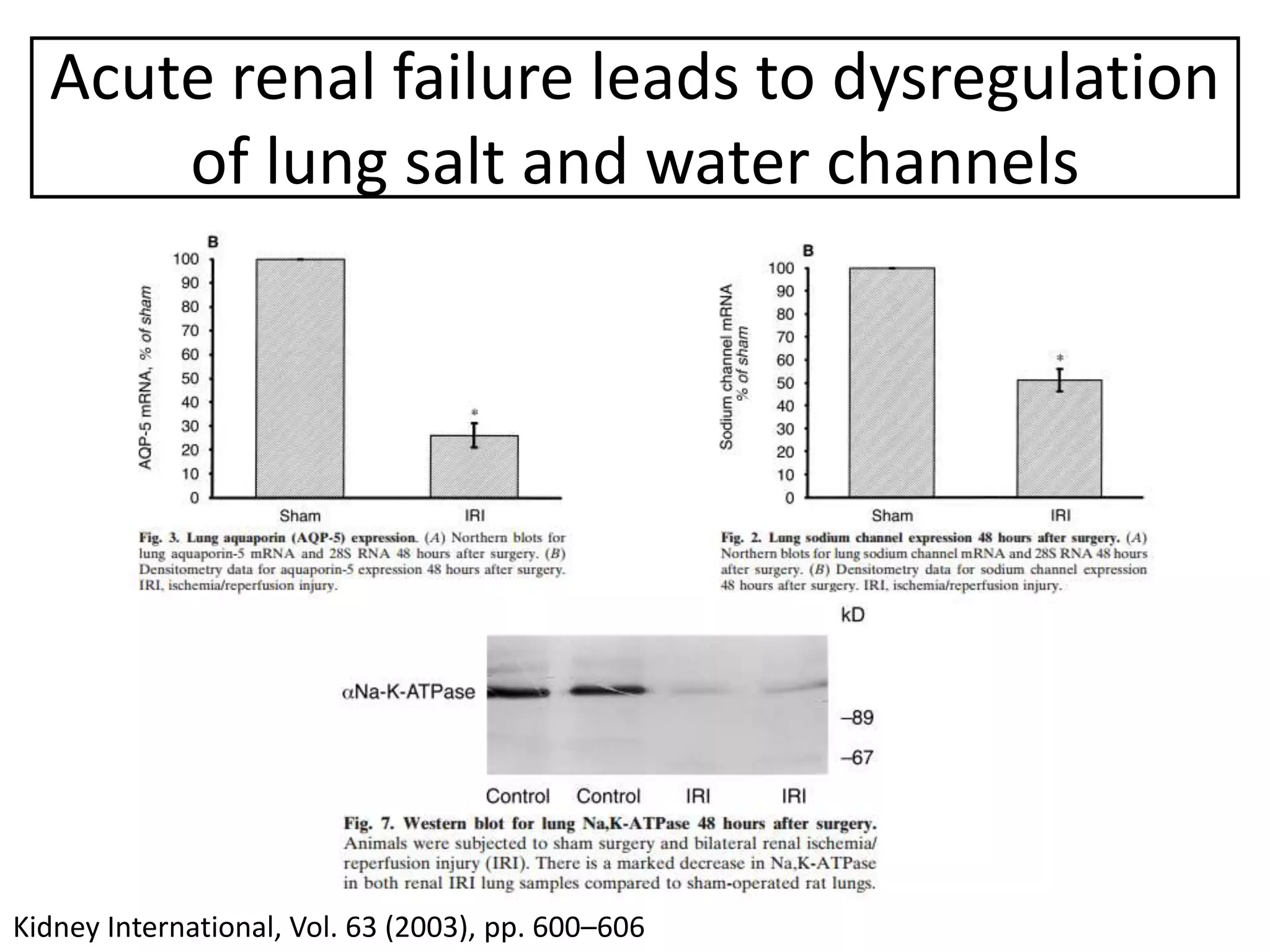 Acute kidney injury and urine output in ICU | PPTX