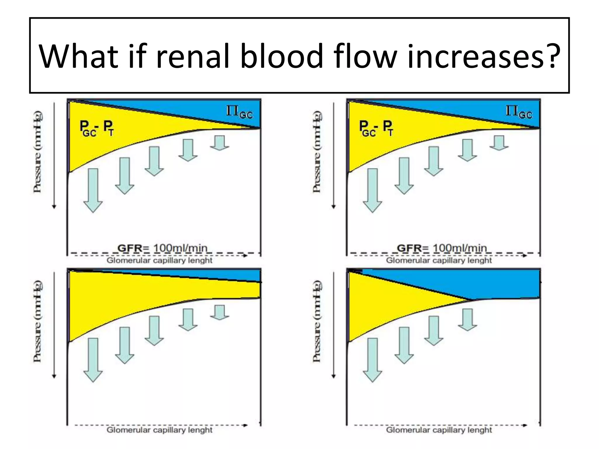 Acute kidney injury and urine output in ICU | PPTX