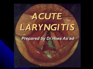 ACUTE LARYNGITIS Prepared by Dr.Hiwa As’ad 