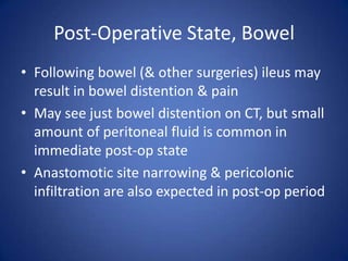 Post-Operative State, Bowel
• Following bowel (& other surgeries) ileus may
result in bowel distention & pain
• May see just bowel distention on CT, but small
amount of peritoneal fluid is common in
immediate post-op state
• Anastomotic site narrowing & pericolonic
infiltration are also expected in post-op period
 