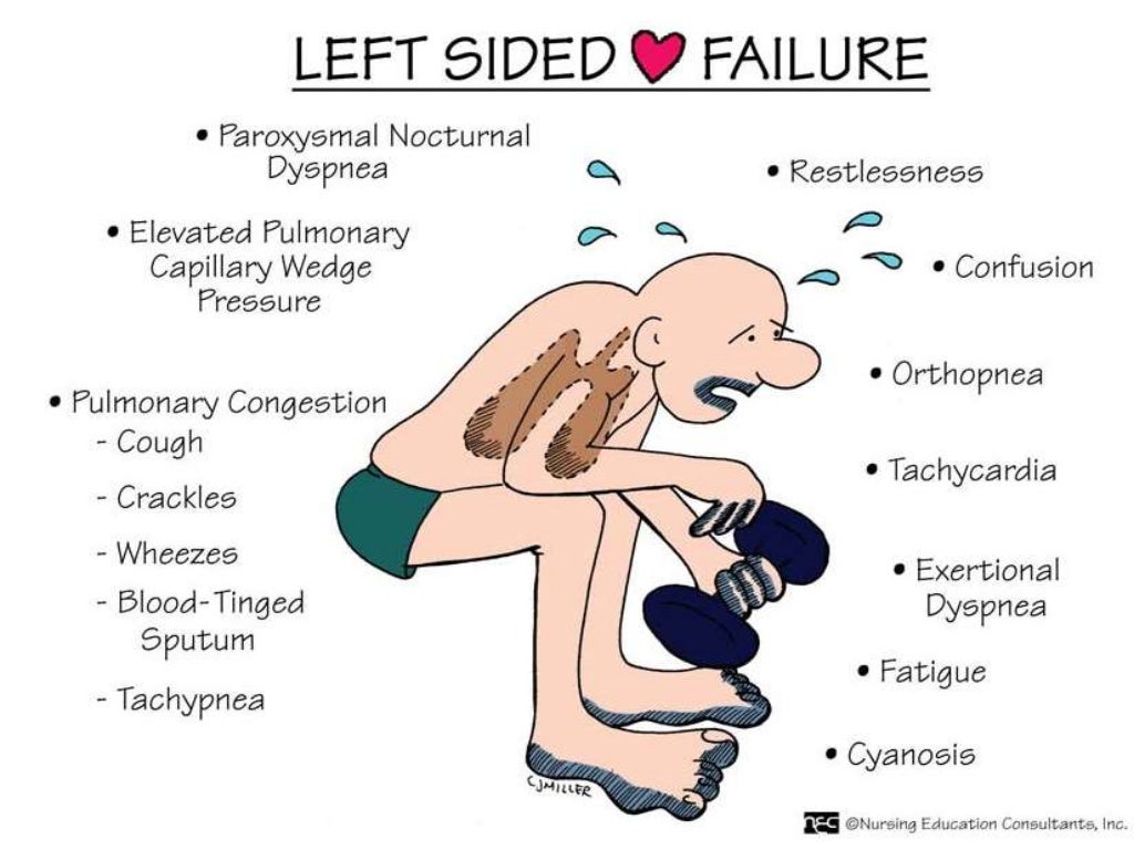 Acute left ventricular failure