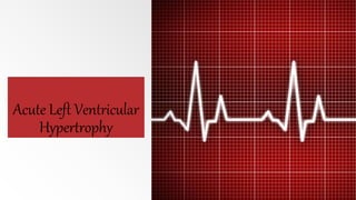Acute Left Ventricular
Hypertrophy
 