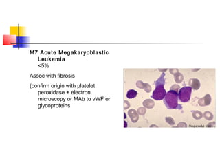 M7 Acute Megakaryoblastic 
Leukemia 
<5% 
Assoc with fibrosis 
(confirm origin with platelet 
peroxidase + electron 
microscopy or MAb to vWF or 
glycoproteins 
 