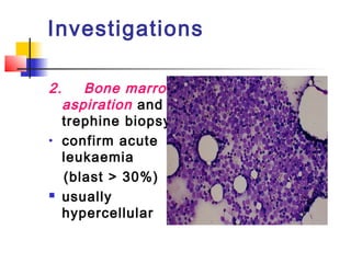 Investigations 
2. Bone marrow 
aspiration and 
trephine biopsy 
· confirm acute 
leukaemia 
(blast > 30%) 
 usually 
hypercellular 
 
