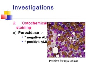 Investigations 
3. Cytochemical 
staining 
a)	 Peroxidase :- 
 * negative ALL 
 * positive AML 
Positive for myeloblast 
 
