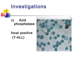 Investigations 
c) Acid 
phosphatase : 
focal positive 
(T-ALL) 
 