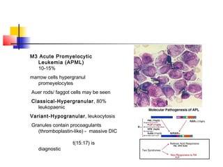 M3 Acute Promyelocytic 
Leukemia (APML) 
10-15% 
marrow cells hypergranul 
promeyelocytes 
Auer rods/ faggot cells may be seen 
Classical-Hypergranular, 80% 
leukopaenic 
Variant-Hypogranular, leukocytosis 
Granules contain procoagulants 
(thromboplastin-like) - massive DIC 
t(15:17) is 
diagnostic 
 