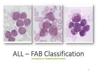 ACUTE LEUKAEMIA IN MYELOCYTIC AND LYMPHOCYTIC LINEAGE .pdf