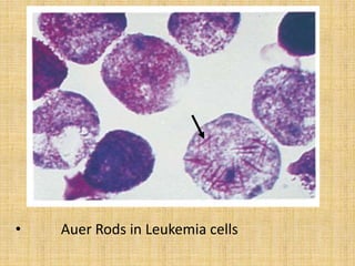 •

Auer Rods in Leukemia cells

 