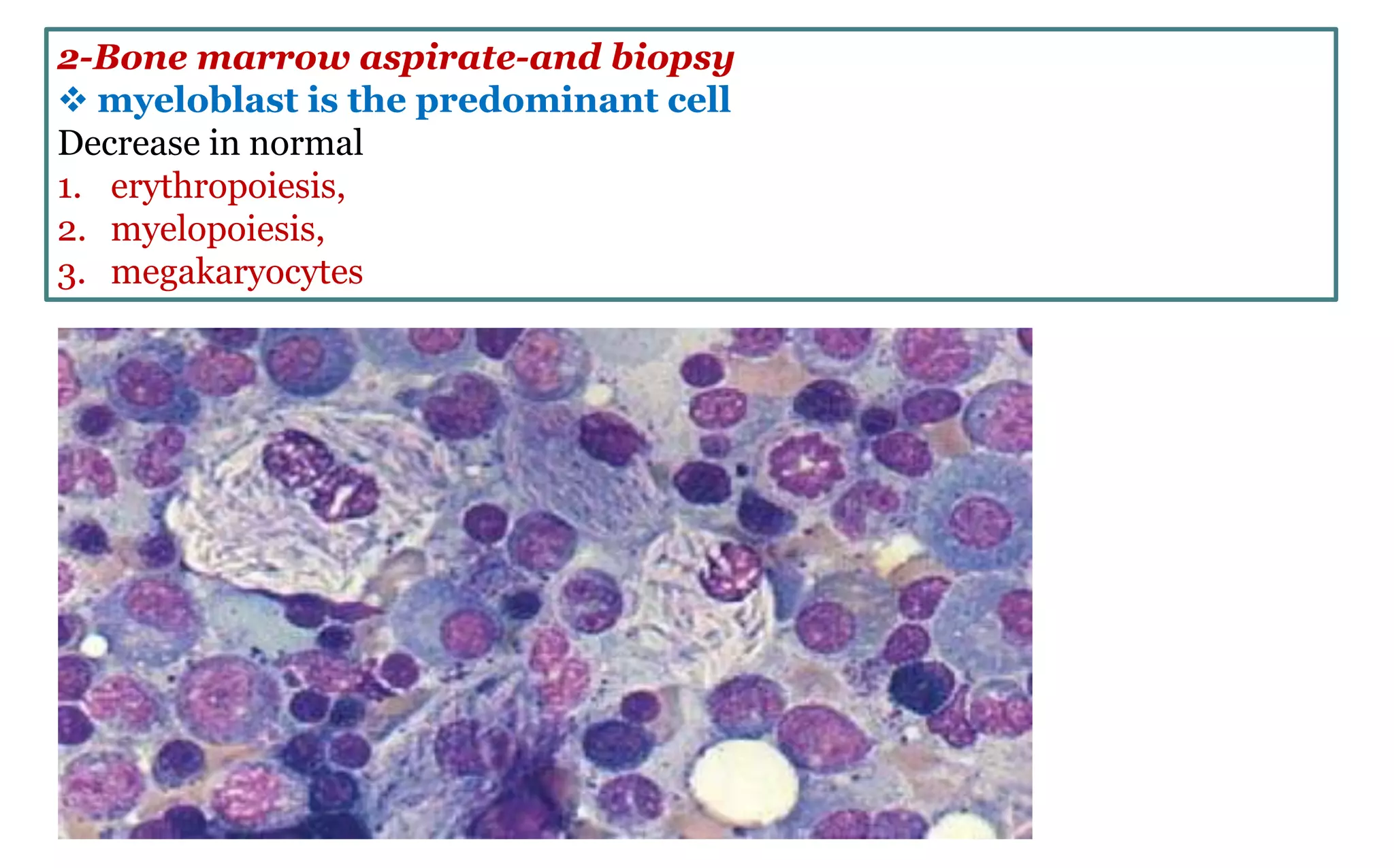 2-Bone marrow aspirate-and biopsy
 myeloblast is the predominant cell
Decrease in normal
1. erythropoiesis,
2. myelopoiesis,
3. megakaryocytes
 