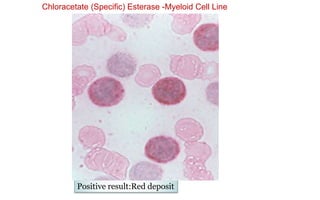 Chloracetate (Specific) Esterase -Myeloid Cell Line
Positive result:Red deposit
 