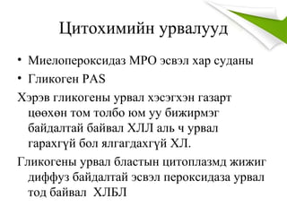 Цитохимийн урвалууд
• Миелопероксидаз MPO эсвэл хар суданы
• Гликоген PAS
Хэрэв гликогены урвал хэсэгхэн газарт
цөөхөн том толбо юм уу бижирмэг
байдалтай байвал ХЛЛ аль ч урвал
гарахгүй бол ялгагдахгүй ХЛ.
Гликогены урвал бластын цитоплазмд жижиг
диффуз байдалтай эсвэл пероксидаза урвал
тод байвал ХЛБЛ
 
