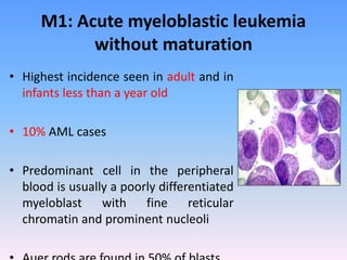 M1: Acute myeloblastic leukemia
without maturation
• Highest incidence seen in adult and in
infants less than a year old
• 10% AML cases
• Predominant cell in the peripheral
blood is usually a poorly differentiated
myeloblast with fine reticular
chromatin and prominent nucleoli
 