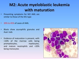 M2: Acute myeloblastic leukemia
with maturation
• Presenting symptoms for M2 AML are
similar to those of the M1 type
• 30% to 45% of cases of AML
• Blasts show azurophilic granules and
Auer rods
• Evidence of maturation is present, with
>10% of the marrow cells being
promyelocytes, myelocytes,
and mature neutrophils and <20%
being monocytes
 