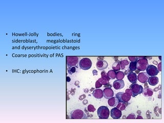 • Howell-Jolly bodies, ring
sideroblast, megaloblastoid
and dyserythropoietic changes
• Coarse positivity of PAS
• IHC: glycophorin A
 