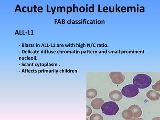 Acute Lymphoid Leukemia
- Blasts in ALL-L1 are with high N/C ratio.
- Delicate diffuse chromatin pattern and small prominent
nucleoli.
- Scant cytoplasm .
- Affects primarily children
FAB classification
ALL-L1
 