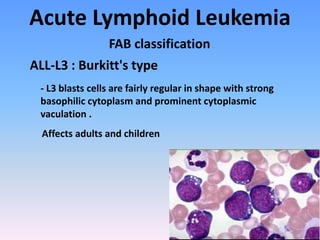 Acute Lymphoid Leukemia
FAB classification
ALL-L3 : Burkitt's type
- L3 blasts cells are fairly regular in shape with strong
basophilic cytoplasm and prominent cytoplasmic
vaculation .
Affects adults and children
 