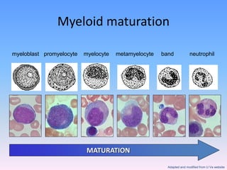 Myeloid maturation
myeloblast promyelocyte myelocyte metamyelocyte band neutrophil
MATURATION
Adapted and modified from U Va website
 