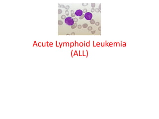 Acute leukemia in children 2021 | PDF