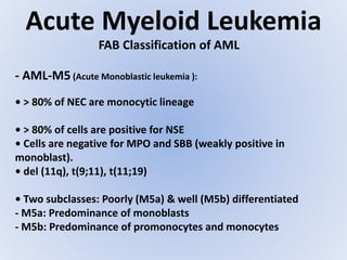 Acute Myeloid Leukemia
FAB Classification of AML
- AML-M5 (Acute Monoblastic leukemia ):
• > 80% of NEC are monocytic lineage
• > 80% of cells are positive for NSE
• Cells are negative for MPO and SBB (weakly positive in
monoblast).
• del (11q), t(9;11), t(11;19)
• Two subclasses: Poorly (M5a) & well (M5b) differentiated
- M5a: Predominance of monoblasts
- M5b: Predominance of promonocytes and monocytes
 