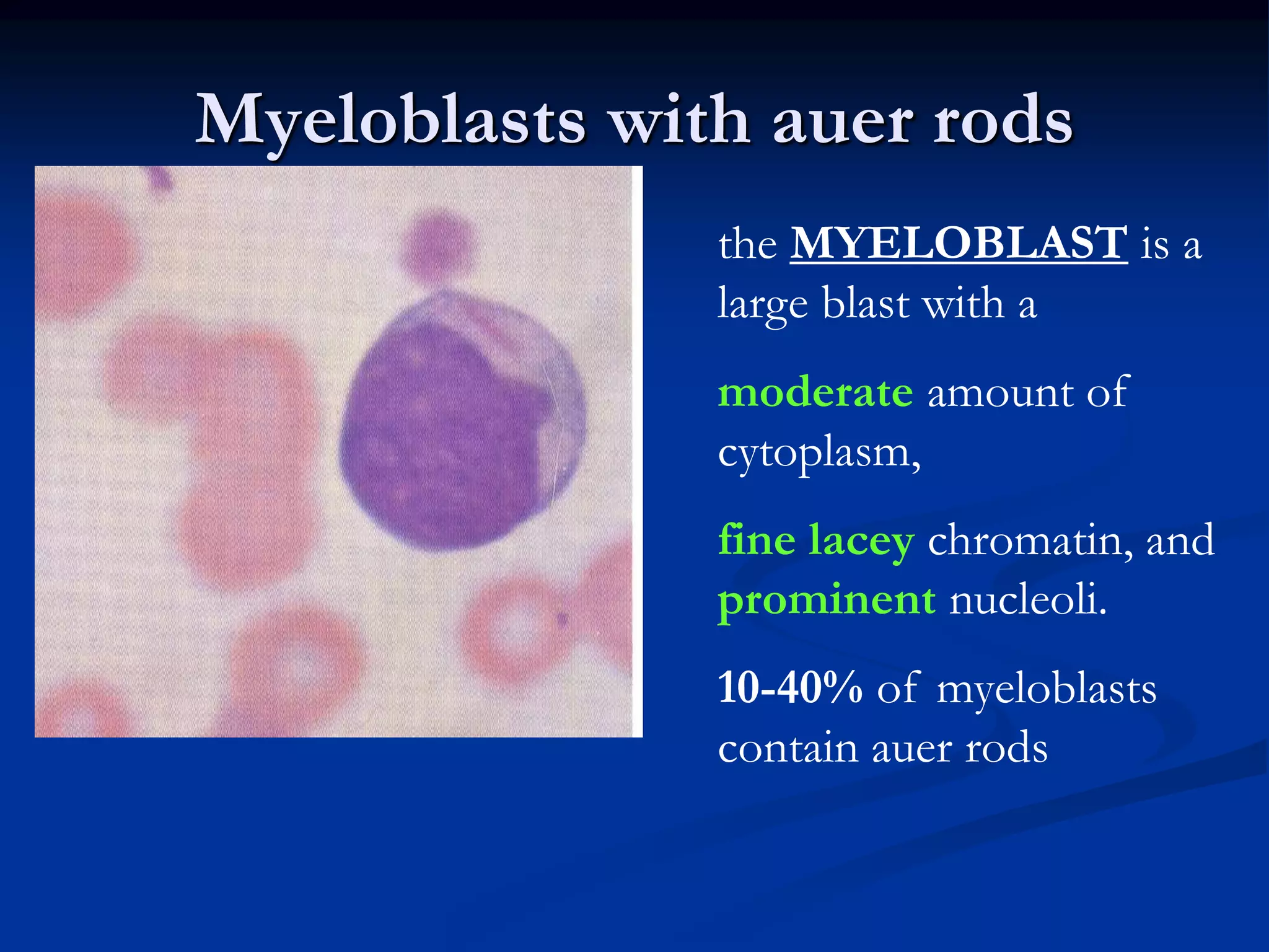 Acute leukemias | PPTX