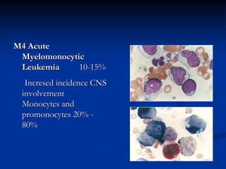 M4 Acute
Myelomonocytic
Leukemia 10-15%
Incresed incidence CNS
involvement
Monocytes and
promonocytes 20% -
80%
 