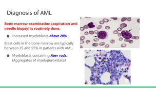 ACUTE LEUKEMIAS presentation made by medical students | PPTX